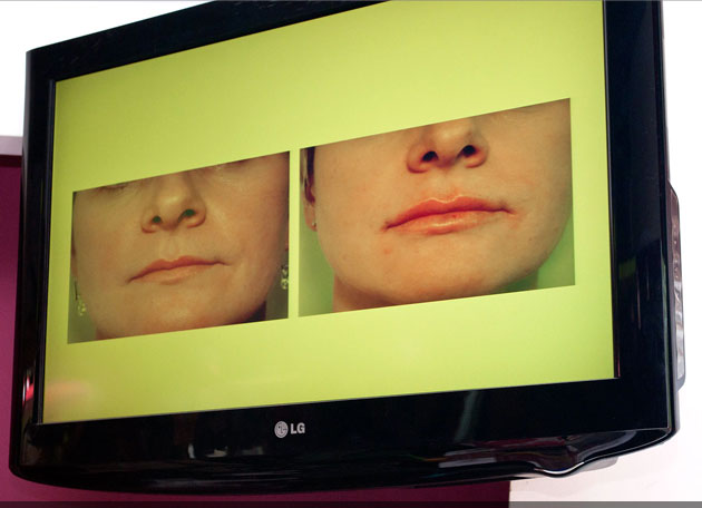 Medicină estetică și la Suceava